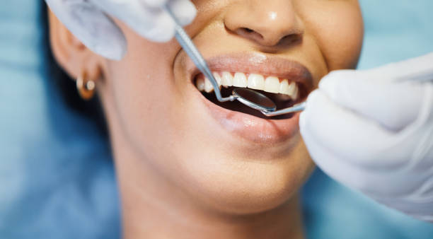 Best Emergency Dentist for Knocked-Out Tooth in Lwa, CA